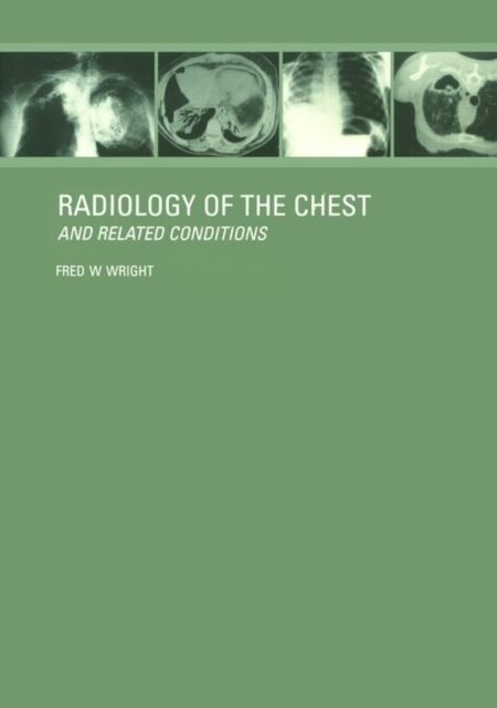 Radiology of the Chest and Related Conditions (Paperback)