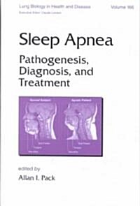 Sleep Apnea (Hardcover)