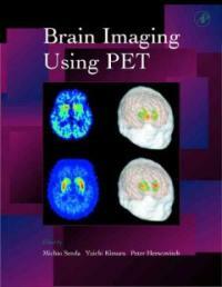 Brain imaging using PET