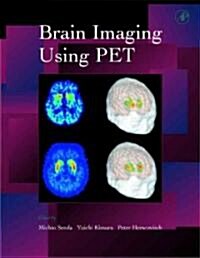 Brain Imaging Using Pet (Hardcover)