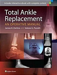 Total Ankle Replacement: An Operative Manual (Hardcover)