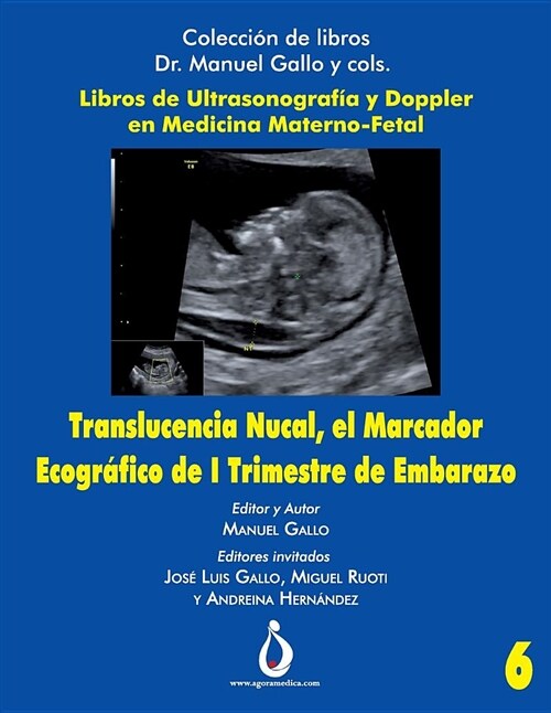 Translucencia Nucal, El Marcador Ecografico de I Trimestre de Embarazo (Paperback)