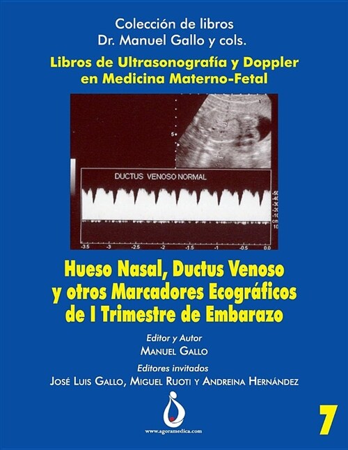 Hueso Nasal, Ductus Venoso Y Otros Marcadores Ecogr?icos de I Trimestre de Embarazo (Paperback)