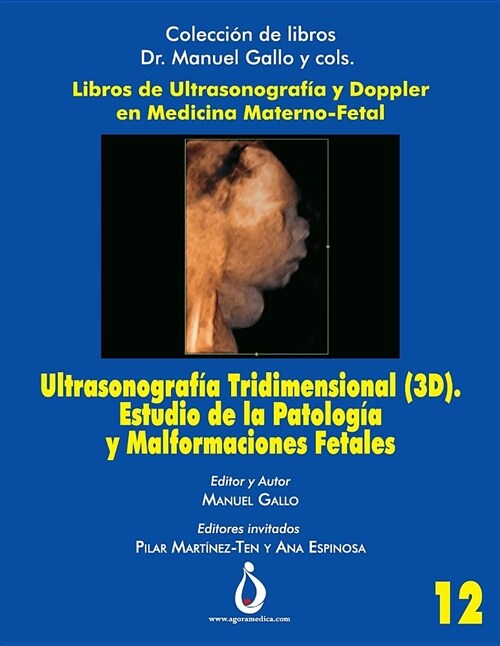Ultrasonograf? Tridimensional (3d). Estudio de la Patolog? Y Malformaciones Fetales (Paperback)