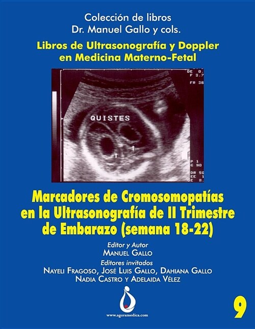 Marcadores Cromosomopat?s En La Ultrasonografia de II Trimestre de Embarazo (Semana 18-22) (Paperback)