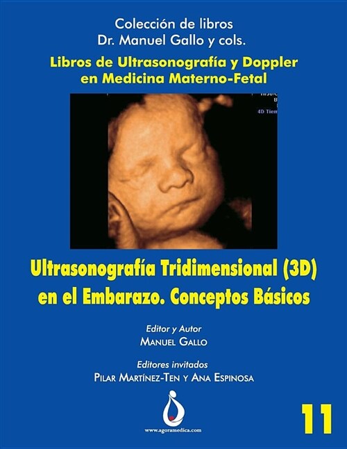 Ultrasonografia Tridimensional En El Embarazo (3d). Conceptos B?icos (Paperback)