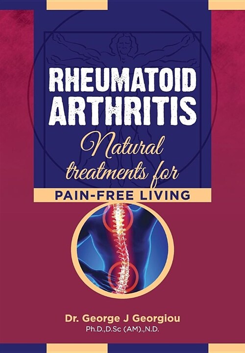 Rheumatoid Arthritis: Natural Treatments for Pain-Free Living (Paperback)