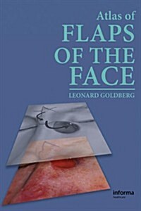 An Atlas of Flaps of the Face (Package)