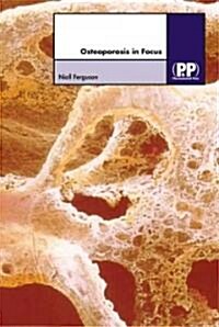 Osteoporosis in Focus (Hardcover)