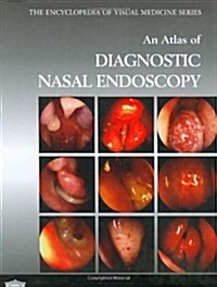 An Atlas of Diagnostic Nasal Endoscopy (Hardcover)