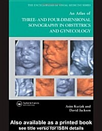 An Atlas of Three- And Four-Dimensional Sonography in Obstetrics and Gynecology (Hardcover)