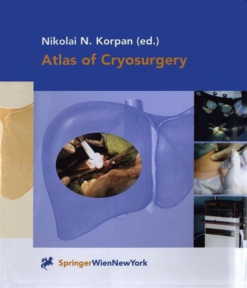 Atlas of Cryosurgery (Paperback, Softcover Repri)