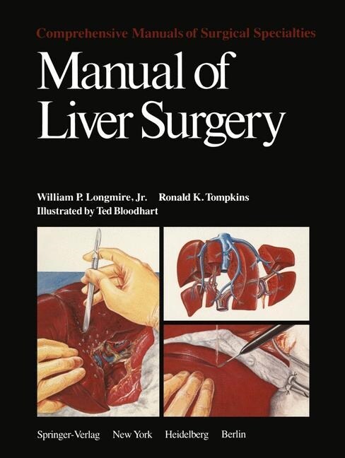 Manual of Liver Surgery (Paperback, Softcover Repri)