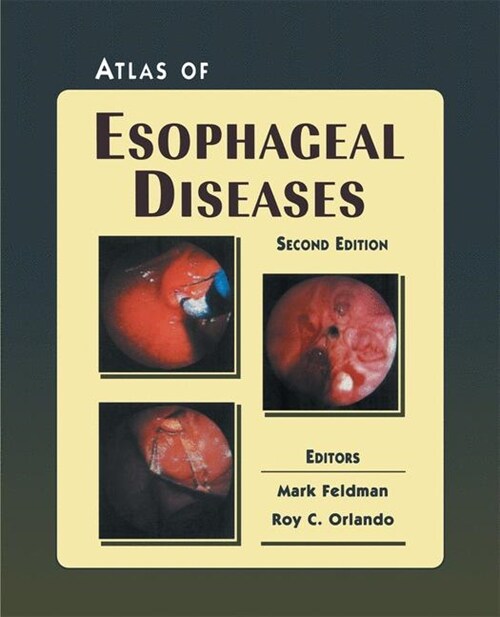 Atlas of Esophageal Diseases (Paperback, 2, Softcover Repri)