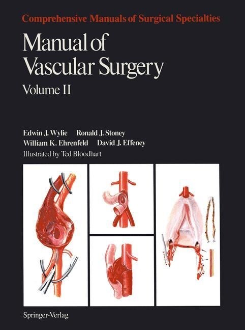 Manual of Vascular Surgery: Volume 2 (Paperback, Softcover Repri)