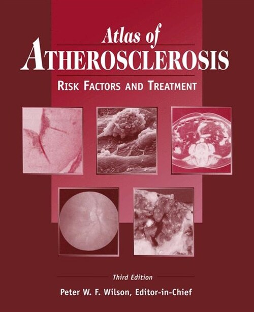 Atlas of Atherosclerosis: Risk Factors and Treatment (Paperback, 3, Softcover Repri)