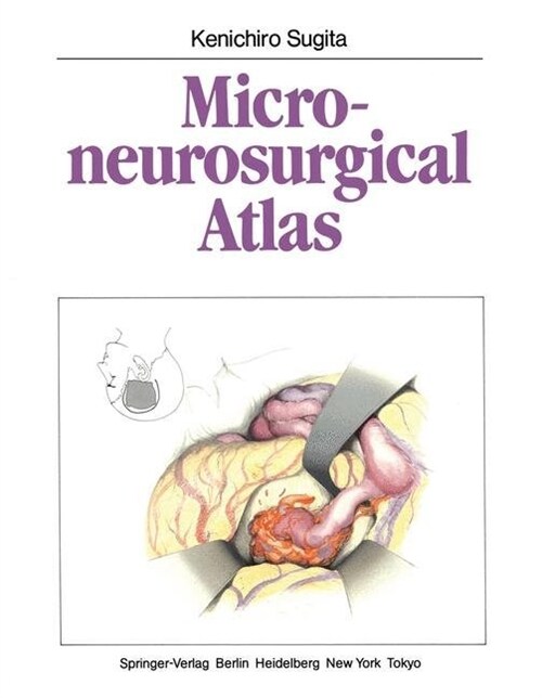 Microneurosurgical Atlas (Paperback, Softcover Repri)