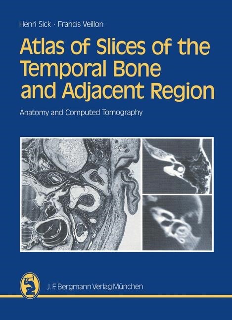 Atlas of Slices of the Temporal Bone and Adjacent Region: Anatomy and Computed Tomography Horizontal, Frontal, Sagittal Sections (Paperback, Softcover Repri)