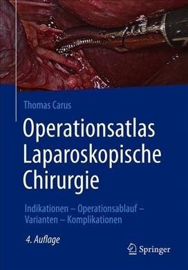 Operationsatlas Laparoskopische Chirurgie: Indikationen - Operationsablauf - Varianten - Komplikationen (Hardcover, 4, 4. Aufl. 2022)