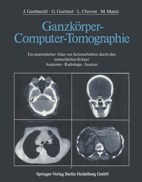 Ganzkorper-Computer-Tomographie : Ein anatomischer Atlas von Serienschnitten durch den menschlichen Korper Anatomie - Radiologie - Scanner (Paperback)