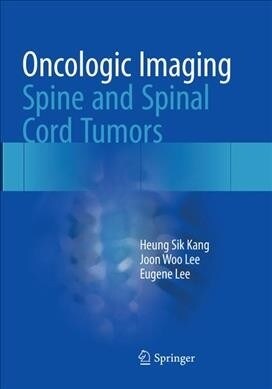 Oncologic Imaging: Spine and Spinal Cord Tumors (Paperback)