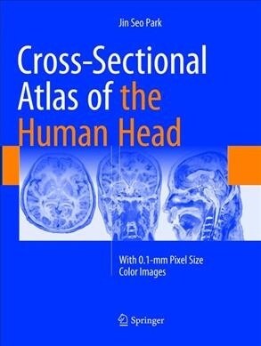 Cross-Sectional Atlas of the Human Head: With 0.1-MM Pixel Size Color Images (Paperback, Softcover Repri)