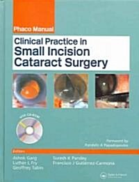 Clinical Practice In Small Incision Cataract Surgery (Hardcover)
