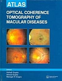 Atlas of Optical Coherence Tomography of Macular Diseases (Hardcover)