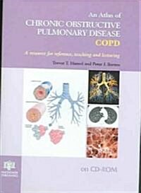 An Atlas Of Chronic Obstructive Pulmonary Disease (CD-ROM)