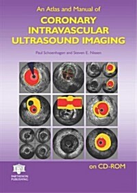 Atlas And Manual Of Coronary Intravascular Ultrasound Imaging (CD-ROM)