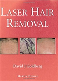 Laser Hair Removal (Hardcover, 1st)