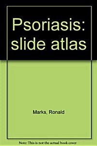 Psoriasis: Slide Atlas (Hardcover)