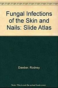 Fungal Infections of the Skin and Nail: Slide Atlas (Hardcover)