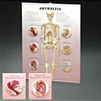 Arthritis (Chart)