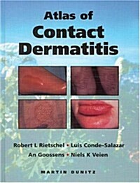 An Atlas of Contact Dermatitis (Hardcover)