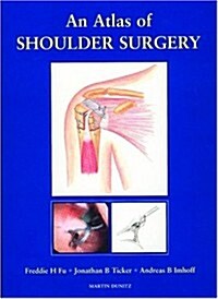 An Atlas of Shoulder Surgery (Hardcover)
