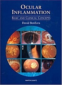 Ocular Inflammation: Basic And Clinical Concepts (Hardcover)