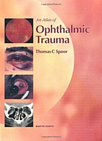 An Atlas of Ophthalmic Trauma (Hardcover)