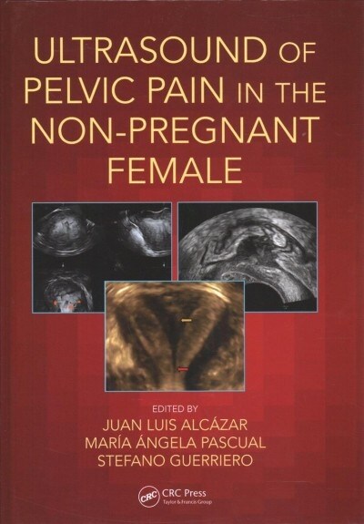 Ultrasound of Pelvic Pain in the Non-Pregnant Patient (Hardcover)