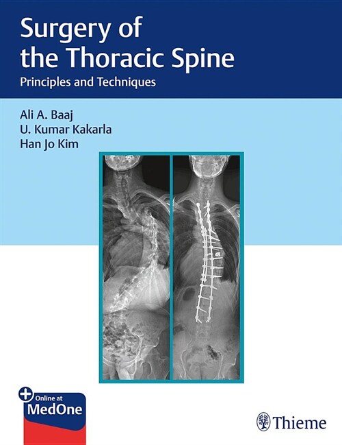 Surgery of the Thoracic Spine: Principles and Techniques (Hardcover)