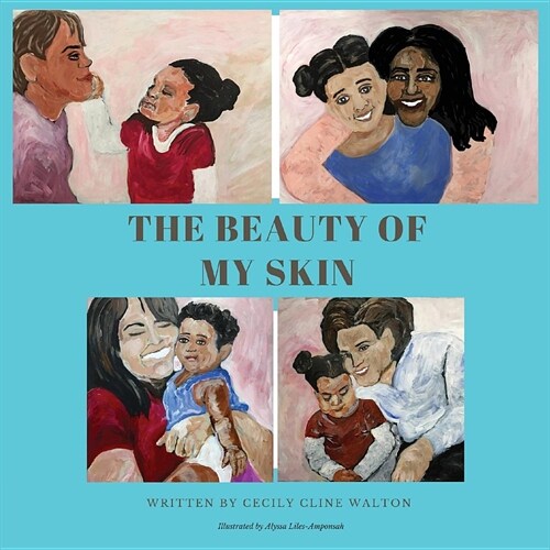 The Beauty of My Skin (Paperback)
