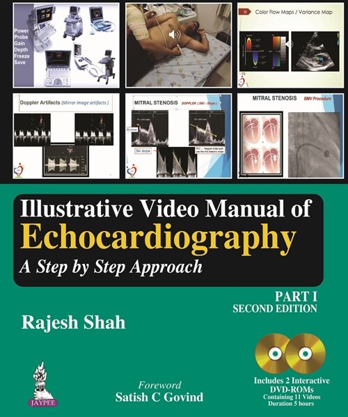Illustrative Video Manual of Echocardiography: A Step by Step Approach - Part 1 (Hardcover, 2)