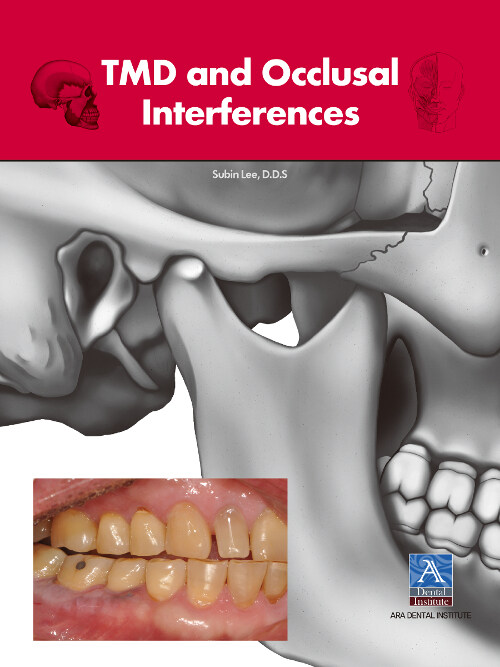 TMD and Occlusal Interferences