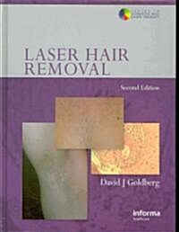 Laser Hair Removal (Hardcover)