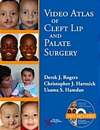 Video Atlas of Cleft Lip and Palate Surgery (Paperback, New)