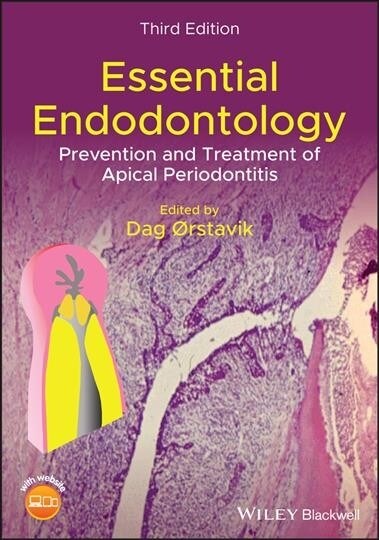 Essential Endodontology: Prevention and Treatment of Apical Periodontitis (Hardcover)