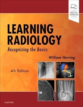 Learning Radiology: Recognizing the Basics (Paperback, 4)
