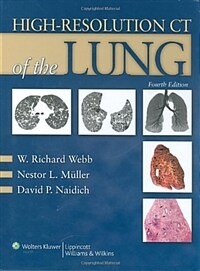 High-resolution CT of the lung 4th ed