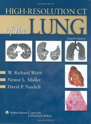 High-Resolution CT of the Lung [With Online Access Code] (Hardcover, 4th)