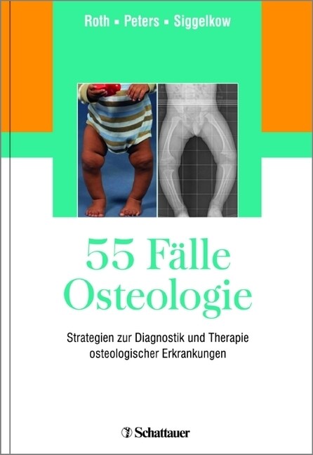 55 Falle Osteologie (Hardcover)